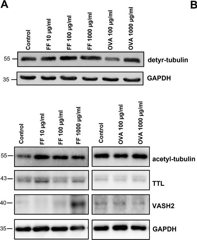 Fig.4.A showing Western Blotting in a Homo sapiens (Human) sample from the publication: Altered Posttranslational Modification of Microtubules Contributes to Disturbed Enterocyte Morphology in Celiac Disease.