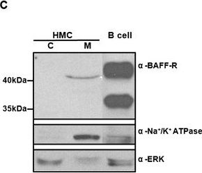 Fig.3.C showing Western Blotting in a Homo sapiens (Human) sample from the publication: BAFF promotes proliferation of human mesangial cells through interaction with BAFF-R.