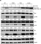 Fig.6.C showing Western Blotting in a Mus musculus (House mouse) sample from the publication: KrasP34R and KrasT58I mutations induce distinct RASopathy phenotypes in mice.