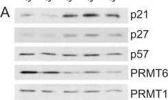 Fig.1.A showing Western Blotting in a Homo sapiens (Human) sample from the publication: Cell cycle regulation by the PRMT6 arginine methyltransferase through repression of cyclin-dependent kinase inhibitors.