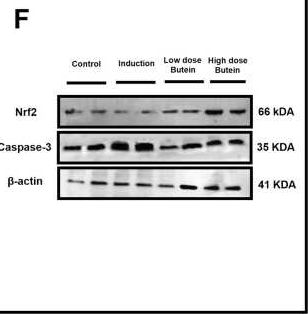 Fig.3.F showing Western Blotting from the publication: Butein mitigates 5-FU-triggered hepatotoxicity via antioxidant, anti-inflammatory, and anti-apoptotic pathways.