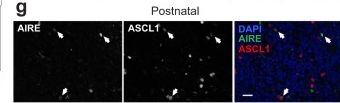 Fig.4.G showing Immunohistochemistry-immunofluorescence from the publication: Single-cell transcriptional profiling of human thymic stroma uncovers novel cellular heterogeneity in the thymic medulla.