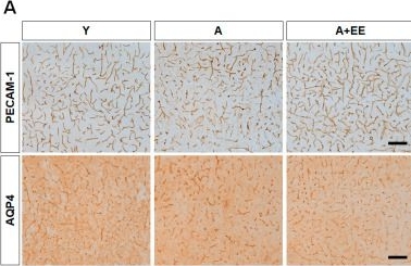 Fig.4.A showing Immunohistochemistry in a Mus musculus (House mouse) sample from the publication: Environmental Enrichment Attenuates Aging-Induced BBB Disruption and Cognitive Impairment with Activation of FNDC5/Irisin Signaling.
