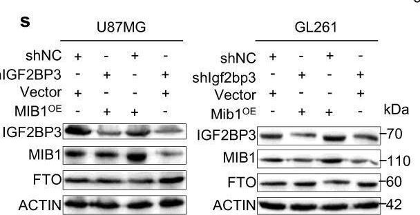 Fig.5.S showing Western Blotting from the publication: Overcoming therapeutic resistance in oncolytic herpes virotherapy by targeting IGF2BP3-induced NETosis in malignant glioma.