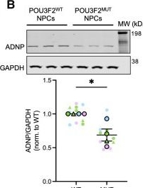 Fig.7.B showing Western Blotting from the publication: POU3F2 regulates canonical Wnt signalling via SOX13 and ADNP to expand the neural progenitor population.
