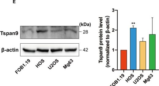 Fig.1.E showing Western Blotting from the publication: Tspan9 Induces EMT and Promotes Osteosarcoma Metastasis via Activating FAK-Ras-ERK1/2 Pathway.
