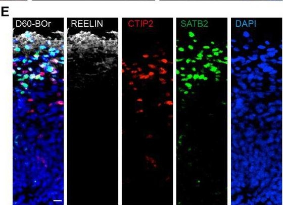 Fig.4.E showing Immunohistochemistry-immunofluorescence in a Homo sapiens (Human) sample from the publication: Generation of vascularized brain organoids to study neurovascular interactions.