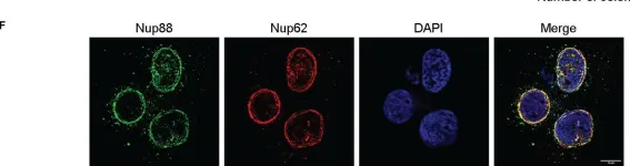 Fig.2.F showing Immunocytochemistry-immunofluorescence from the publication: Overexpressed Nup88 stabilized through interaction with Nup62 promotes NF-κB dependent pathways in cancer.