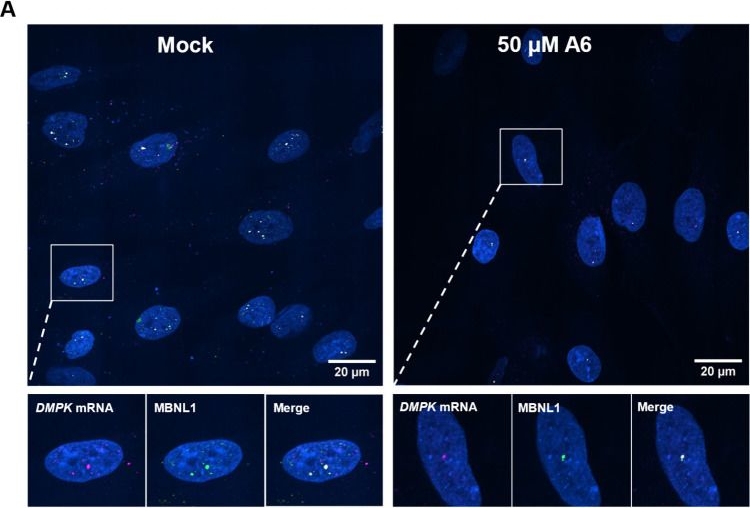 Fig.7.A showing Immunocytochemistry-immunofluorescence in a Homo sapiens (Human) sample from the publication: A Live-Cell NanoBRET Assay to Monitor RNA-Protein Interactions and Their Inhibition by Small Molecules.
