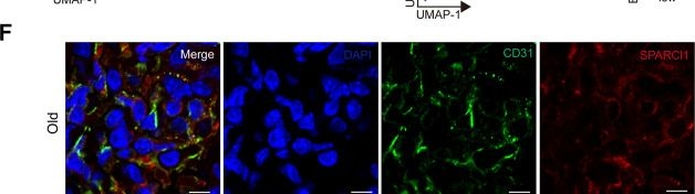Fig.1.F showing Immunohistochemistry-immunofluorescence in a Mus musculus (House mouse) sample from the publication: Assessing the effects of aging on the renal endothelial cell landscape using single-cell RNA sequencing.
