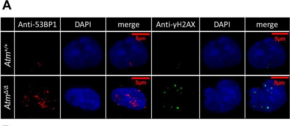 Fig.4.A showing Immunocytochemistry-immunofluorescence from the publication: p38α plays differential roles in hematopoietic stem cell activity dependent on aging contexts.