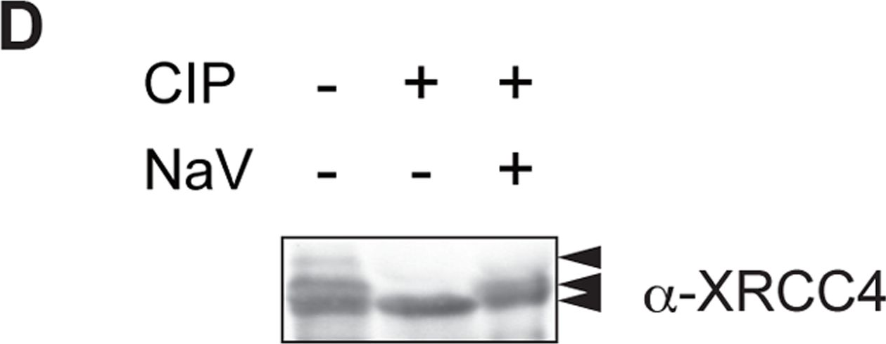 Fig.4.D showing Western Blotting in a Homo sapiens (Human) sample from the publication: Canonical non-homologous end joining in mitosis induces genome instability and is suppressed by M-phase-specific phosphorylation of XRCC4.