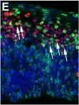 Fig.3.E showing Immunohistochemistry-immunofluorescence in a Mus musculus (House mouse) sample from the publication: A transient role of the ciliary gene Inpp5e in controlling direct versus indirect neurogenesis in cortical development.