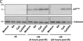 Fig.2.C showing Western Blotting in a Homo sapiens (Human) sample from the publication: TLR9 stimulation of B-cells induces transcription of p53 and prevents spontaneous and irradiation-induced cell death independent of DNA damage responses. Implications for Common variable immunodeficiency.