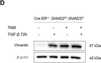 Fig.6.D showing Western Blotting in a Mus musculus (House mouse) sample from the publication: Lack of extracellular matrix switches TGF-β induced apoptosis of endometrial cells to epithelial to mesenchymal transition.