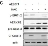 Fig.6.C showing Western Blotting from the publication: The N-terminal tail coordinates with carbohydrate recognition domain to mediate galectin-3 induced apoptosis in T cells.