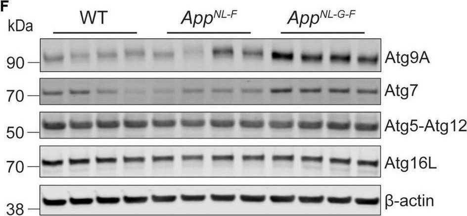 Fig.3.F showing Western Blotting in a Mus musculus (House mouse) sample from the publication: Autophagy Impairment in App Knock-in Alzheimer's Model Mice.