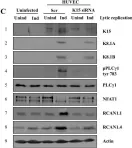 Fig.10.C showing Western Blotting from the publication: Kaposi's sarcoma herpesvirus K15 protein contributes to virus-induced angiogenesis by recruiting PLCγ1 and activating NFAT1-dependent RCAN1 expression.