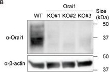 Fig.3.B showing Western Blotting in a Homo sapiens (Human) sample from the publication: Orai1 is an Entotic Ca2+ Channel for Non-Apoptotic Cell Death, Entosis in Cancer Development.