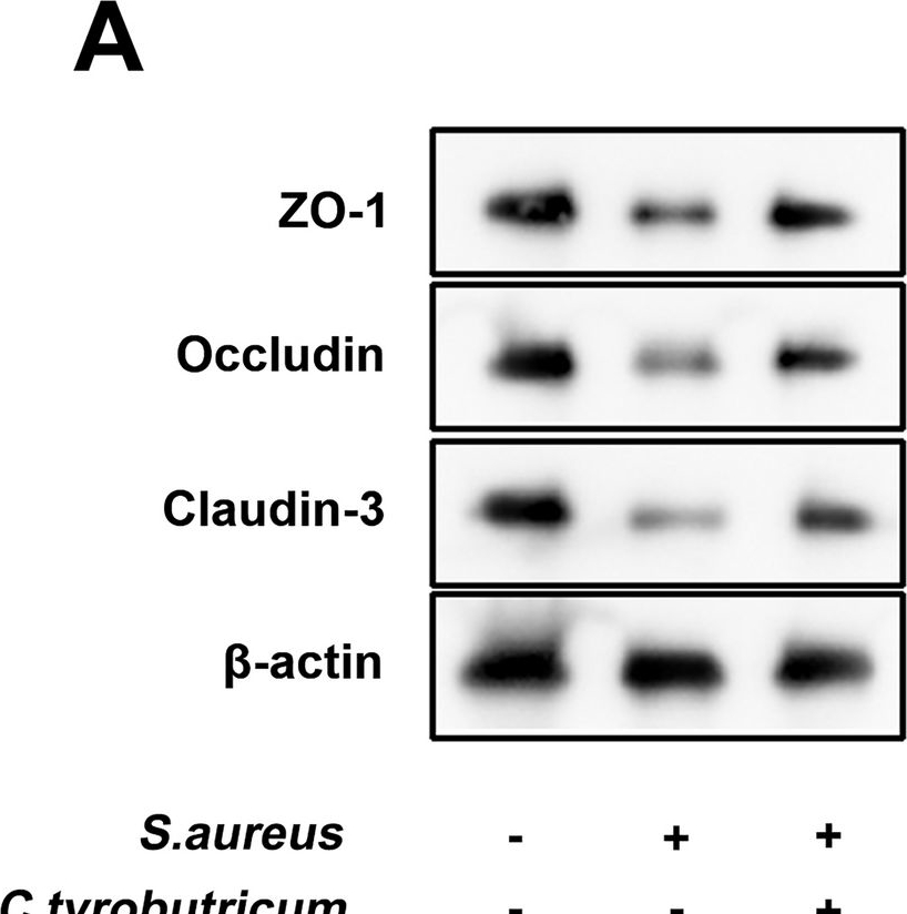 Fig.10.A showing Western Blotting in a Homo sapiens (Human) sample from the publication: Microbiome dysbiosis in patients with chronic endometritis and Clostridium tyrobutyricum ameliorates chronic endometritis in mice.