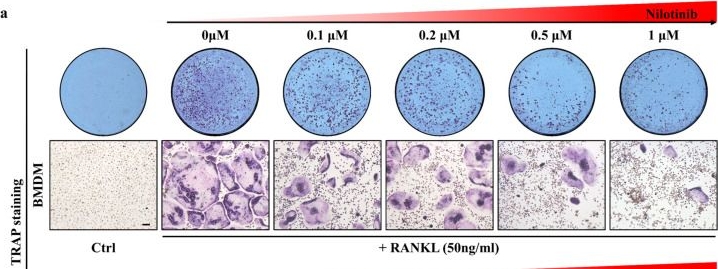 Fig.6.A from the publication: Targeting Osteoporosis-Osteoarthritis Comorbidity: Multi-Omics Identification of SON and Exploration of Therapeutic Agents.