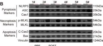 Fig.3.B showing Western Blotting from the publication: Liver-Targeted Gallium-Polyphenol Network by Disrupting the ROS/NETs/PANoptosis Axis for Precision Acute Liver Injury Therapy.