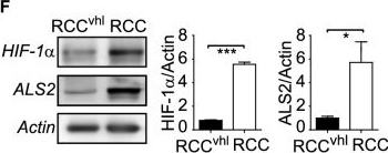 Fig.2.F showing Western Blotting in a Homo sapiens (Human) sample from the publication: The RabGEF ALS2 is a hypoxia inducible target associated with the acquisition of aggressive traits in tumor cells.