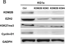 Fig.4.B showing Western Blotting in a Homo sapiens (Human) sample from the publication: The KDM2B- let-7b -EZH2 axis in myelodysplastic syndromes as a target for combined epigenetic therapy.