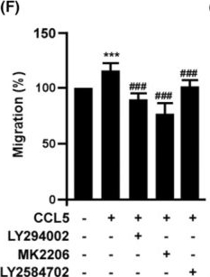 Fig.2.F from the publication: Senescence induces miR-409 to down-regulate CCL5 and impairs angiogenesis in endothelial progenitor cells.