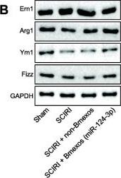 Fig.7.B showing Western Blotting in a Rattus norvegicus (Rat) sample from the publication: Bone marrow mesenchymal stem cell-derived exosomal microRNA-124-3p attenuates neurological damage in spinal cord ischemia-reperfusion injury by downregulating Ern1 and promoting M2 macrophage polarization.