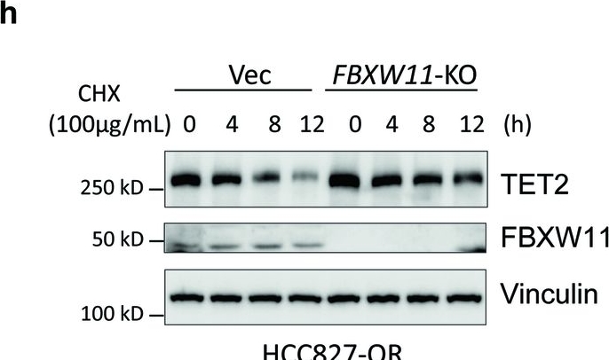 Fig.4.H showing Western Blotting in a Homo sapiens (Human) sample from the publication: Tet methylcytosine dioxygenase 2 (TET2) deficiency elicits EGFR-TKI (tyrosine kinase inhibitors) resistance in non-small cell lung cancer.
