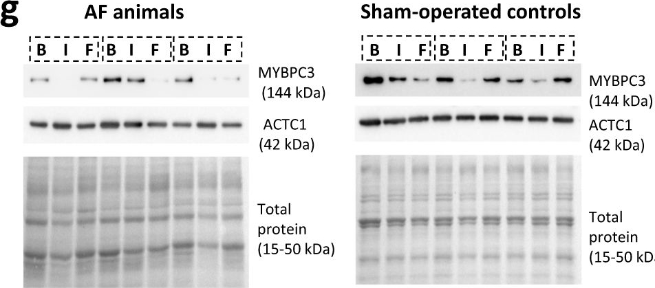 Fig.4.G showing Western Blotting in a Homo sapiens (Human) sample from the publication: Non-invasive electromechanical assessment during atrial fibrillation identifies underlying atrial myopathy alterations with early prognostic value.