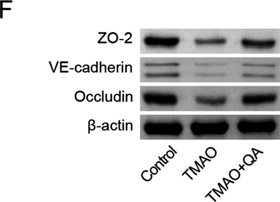 Fig.8.F showing Western Blotting from the publication: Quinic acid regulated TMA/TMAO-related lipid metabolism and vascular endothelial function through gut microbiota to inhibit atherosclerotic.