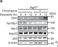 Fig.1.A showing Western Blotting from the publication: Optineurin is an adaptor protein for ubiquitinated substrates in Golgi membrane-associated degradation.