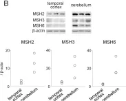 Fig.5.B showing Western Blotting from the publication: Large expansion of CTG•CAG repeats is exacerbated by MutSβ in human cells.