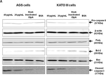 Fig.4.A showing Western Blotting from the publication: Binding of the Helicobacter pylori OipA causes apoptosis of host cells via modulation of Bax/Bcl-2 levels.