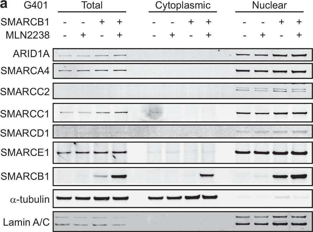 Fig.4.A showing Western Blotting from the publication: Renal medullary carcinomas depend upon SMARCB1 loss and are sensitive to proteasome inhibition.