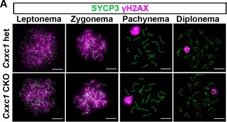 Fig.7.A showing Immunocytochemistry-immunofluorescence in a Mus musculus (House mouse) sample from the publication: CXXC1 is not essential for normal DNA double-strand break formation and meiotic recombination in mouse.