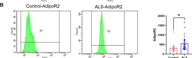 Fig.2.B showing Flow cytometry/Cell sorting in a Homo sapiens (Human) sample from the publication: Unlocking amyotrophic lateral sclerosis: the role of adiponectin in inflammation and disease progression.