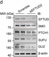 Fig.4.D showing Western Blotting in a Homo sapiens (Human) sample from the publication: Alternative spliceosomal protein Eftud2 mediated Kif3a exon skipping promotes SHH-subgroup medulloblastoma progression.