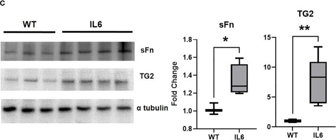 Fig.5.C showing Western Blotting from the publication: Lung-specific interleukin 6 mediated transglutaminase 2 activation and cardiopulmonary fibrogenesis.