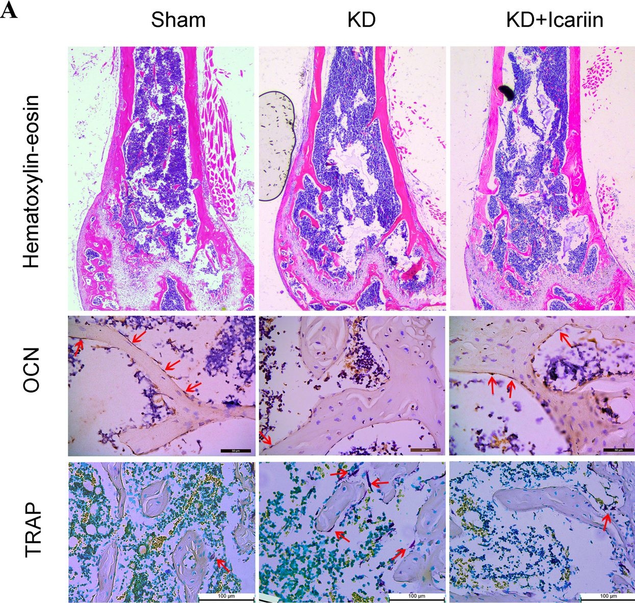 Fig.4.A showing Immunohistochemistry in a Mus musculus (House mouse) sample from the publication: Icariin promotes bone marrow mesenchymal stem cells osteogenic differentiation via the mTOR/autophagy pathway to improve ketogenic diet-associated osteoporosis.