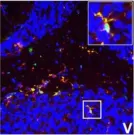 Fig.7.V showing Immunohistochemistry-immunofluorescence in a Mus musculus (House mouse) sample from the publication: IFN-gamma signaling in the central nervous system controls the course of experimental autoimmune encephalomyelitis independently of the localization and composition of inflammatory foci.