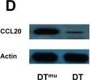 Fig.5.D showing Western Blotting in a Mus musculus (House mouse) sample from the publication: Tumor-associated macrophages recruit CCR6+ regulatory T cells and promote the development of colorectal cancer via enhancing CCL20 production in mice.