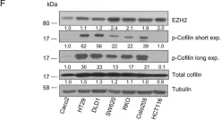 Fig.1.F showing Western Blotting from the publication: EZH2 regulates cofilin activity and colon cancer cell migration by targeting ITGA2 gene.