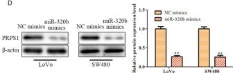 Fig.6.D showing Western Blotting from the publication: LncRNA DLEU1 Contributes to the Growth and Invasion of Colorectal Cancer via Targeting miR-320b/PRPS1.
