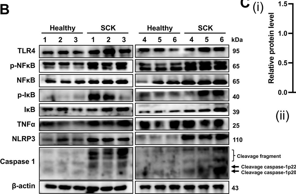 Fig.2.B showing Western Blotting in a Bos taurus (Bovine) sample from the publication: Proinflammatory polarization of adipose tissue macrophages in cows with subclinical ketosis constitutes a critical driver of adipose tissue remodeling and inflammation.