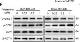 Phospho-cdc2 (Tyr15) (10A11) Rabbit Monoclonal Antibody | Cell