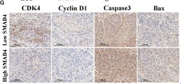 Fig.7.G showing Immunohistochemistry in a Homo sapiens (Human) sample from the publication: LncRNA MTX2-6 Suppresses Cell Proliferation by Acting as ceRNA of miR-574-5p to Accumulate SMAD4 in Esophageal Squamous Cell Carcinoma.