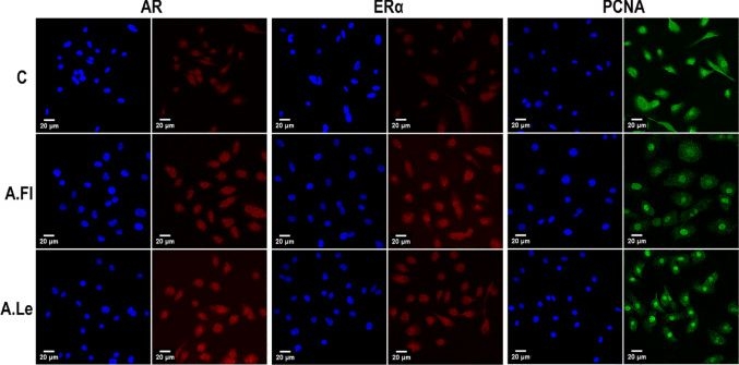 Fig.2.C showing Immunocytochemistry-immunofluorescence in a Homo sapiens (Human) sample from the publication: Anti-hyperplastic effects of Acmella oleracea flower and leaf extracts in prostate cell lines and in spontaneously hypertensive rats.